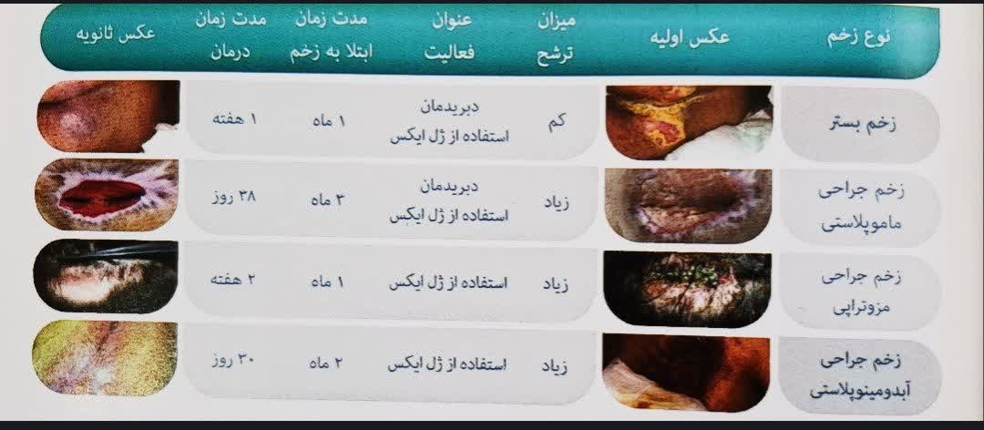ژل ایکس 12gr تریتا